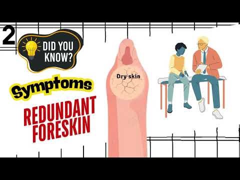 Did You Know About Redundant Foreskin?