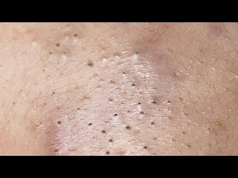 Relax Every Day With Sac Dep Spa #0263