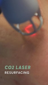 Pulse Light Clinic on Reels