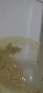 Korean girl diarrhea 2