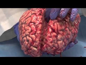 What would it really feel like to touch a human brain?