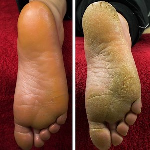 The summer pedicure transformation we need! | Creative Corner | Facebook