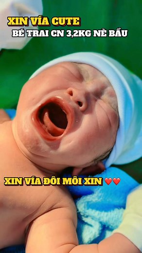 209K views · 9.3K reactions | ĐÔI MÁ CÓ ĐỒNG TIỀN DUYÊN  NHÃ VÍA NHÃ VÍA ❤️❤️MỘT CHIẾC MÔI XINH  XIN VÍA CUTE NÈ BẦU ❤️❤️ BẦU XIN VÍA NÈ ❤️❤️❤️ | Khoa Sản Phụ - Bệnh Viện Đa Khoa Medic Bình Dương | Facebook