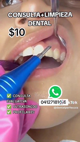 Estamos agendando: 04127181418 #odontologia #carillasdentales #caracas #promo #protesisdental #Venezuela