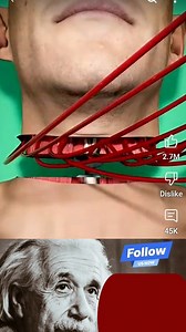 19K views · 44 reactions | Full Body Transplant  #post2025シ #unfollow #reelsfacebook #sigmaphysicsteacher | Physics Einstein Sigma | Facebook