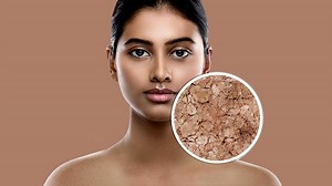 Dry Skin: Natural Remedies You Can Make At Home