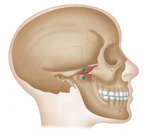 Trigger Point Therapy - Lateral Pterygoid Muscle