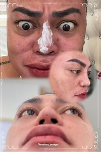 423K views · 10K reactions | TABINGI : Pina ayos ko ang ilong ko baka kaya pa gawan ng Paraan ng Julyna Aesthetic Clinic Aesthetic Julyna Aesthetic Clinic | Brenda Mage | Facebook