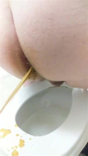 Toilet diarrhea spray