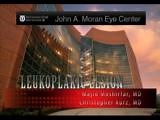Leukoplakic Lesion - Eyetube