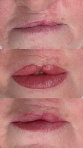 👄Challenging Lips Case Study: Mature Client with Cleft Lip Surgery Scarring. 🤩In this case, PRO Team artist Ramona Krusinskiene (@monapmuacademy) navigates the intricate landscape of her client's lip transformation. Ramona's meticulous approach involved technical precision and a deep understanding of her client's emotional journey. 💯Created using PIXL 0.25mm 1RL LT Needle Cartridge and a custom mix of colors from the Envy Lip Collection. Ramona used Cinnamon and Wine (50/50) for the contour a