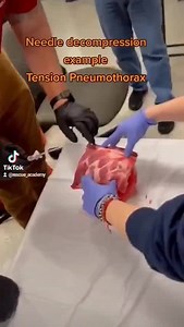 Needle decompression demonstration in paramedic school! It's a rack of ribs and a balloon, great way to train. #paramedic #EMT #nurse #EMS | Rescue Academy