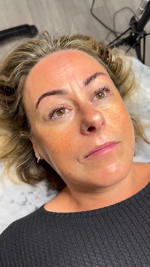 A full morning of Holiday preparation for @ableylaura. Luxury Facial and Dermaplane, Brow sculpt and Lash Lift & Tint 💁‍♀️#glowingskin #tightenskin #firmingskin #ckaesthetics #aesthetics #beauty #lashliftandtint #browstyling #aldridge #lazyhill | CK Aesthetics & Beauty