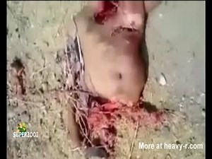 Ripped Off Limbs And Body Parts