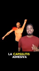 4.8K views · 56 reactions | Capsulitis adhesiva. . . . .#anatomía #fisioterapeuta #fisioterapia #cirugia #rehabilitacion #rehabilitacionfisica #reelsvideoシ #reelsvideoシfyp #reelsviralシ | Fisioterapia y rehabilitación Puebla | Facebook