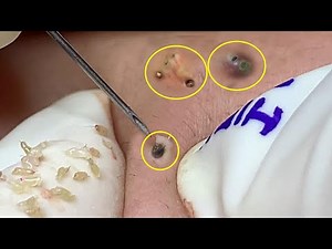 Satisfying Hien Spa Beauty Relaxing Video #30