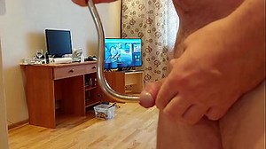 Guyon Sounding Rod Is Pushed Into Urethra