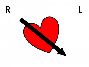 27 reactions | Cardiac Axis - Rule of Thumbs #CCU_ECG | CCU | Facebook