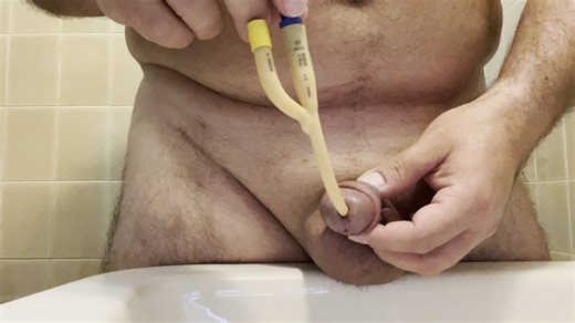 CH20 catheter removal. Very painful!!