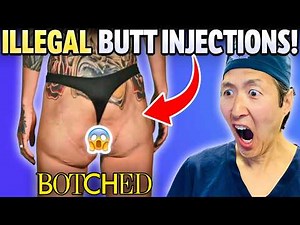 Her Butt Was BOTCHED! Extreme Compilation of Plastic Surgeon Reacts to BOTCHED