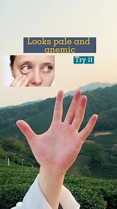 #tryitout #foryourpageシ #LoveYourHealth #lowblood #justforreels #exercise | Ray Ann