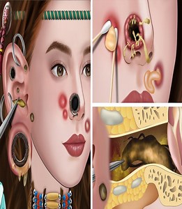 The best treatment of crab bites in the ear causes ear infection, swelling of the ear piercing | Lline Theodora