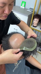 Hairpiece for Men: Natural-Looking Non-Surgical Hair Replacement