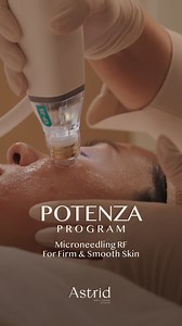 Firm, Refined, and Renewed Skin – All in one program! Potenza Microneedling RF targets both tightening and acne scars. Begin your personalized Potenza Program with post-treatment Homecare Kit for the ultimate skin recovery – exclusively at Astrid Anti-Aging Studio💫 ฟื้นผิวกระชับ เรียบเนียน พร้อมดูแลหลุมสิวในหนึ่งเดียว โปรแกรม Potenza Microneedling RF ที่มาพร้อมคุณสมบัติแห่งการกระชับผิว ช่วยให้รูขุมขน ความไม่เรียบเนีน และหลุมสิวแลดูจางลง พร้อมรับชุดปลอบประโลมผิวเพื่อการฟื้นฟูอย่างอ่อนโยนและเต็มป