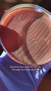 2.2K views · 279 reactions | Can You Smell This Through The Phone 﫠 #Iykyk #healthcare #medtech #doctor #nurse #medicine | Marilyn Claire | Facebook