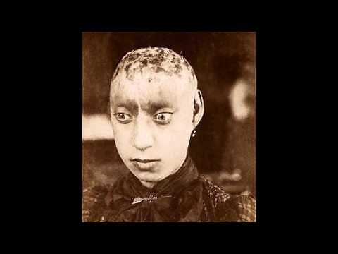 Victorian Asylum Patient Photos.US and UK. How our ancestors who had mental illness were treated.