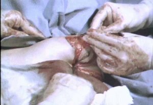 Clip D378_30_038, from Dissolve