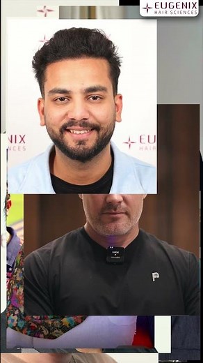 Best Hair Transplant Solutions by Eugenix Hair Sciences | Restore Hair Naturally