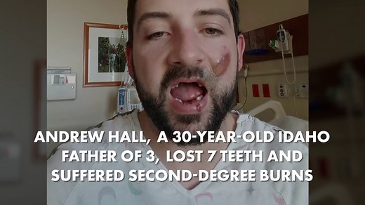 Exploding e-cig knocks 7 teeth out of man’s mouth