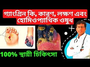Gangrene Homeopathy Medicine for Gangrene and Diabetic Foot Ulcer - Natural Treatment