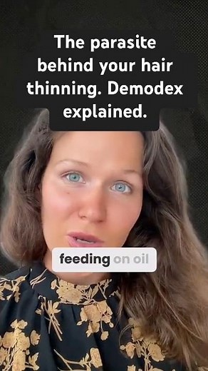 Natural Shampoo Won’t Save You If You Have This on Your Scalp. #demodex #scalphealth #hairloss