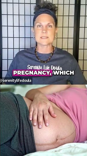 Breech Birth: Choosing Education Over Fear