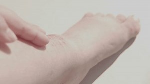 La main applique de l'onguent sur : vidéo de stock (100 % libre de droit) 3928933569 | Shutterstock