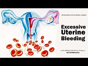 Excessive Uterine Bleeding - Jaypess Institute of Medical Science - Silchar