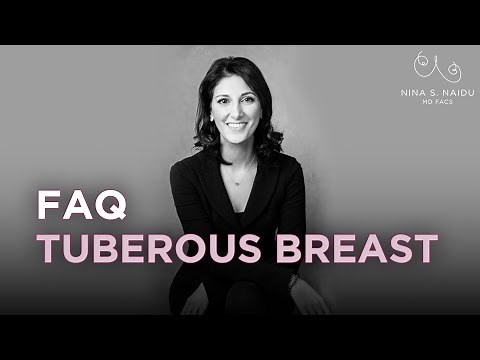 Tuberous Breast Deformity - Frequently Asked Questions - Nina S. Naidu, MD FACS - NYC