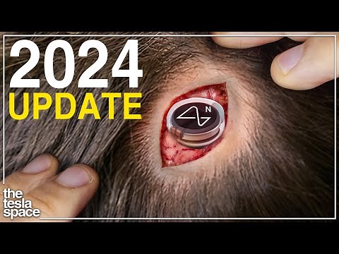 The 2024 Neuralink Update Is Here!
