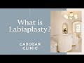 What is Labiaplasty