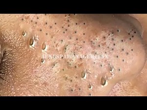 Enjoy Every Day With The Best Video Loan Nguyen Spa Official 1982