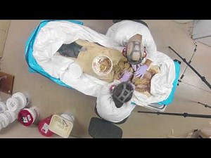Cadaver Dissection Timelapse
