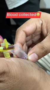 2.7K views · 20 reactions | How to collect blood in newborn baby #trending #nursing #project | Barkat Choudhry | Facebook