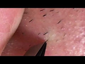 【pull out the beard】ずっと見てられる悠久のヒゲ抜き 2018.5.7