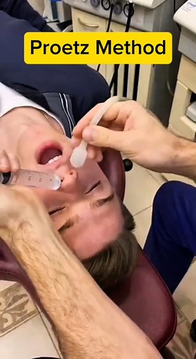 Nasal sinus drainage with Proetz method #nasaldrainage #sinusdrainage #drainage #proetz #sinusrelief #nasalrinse #viralvideo