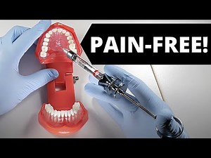 Deliver A Painless Palatal Injection  • Video • MEDtube.net