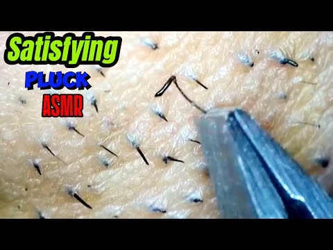 satisfying facial hair plucking FOLLICLES ASMR | Under the Microscope