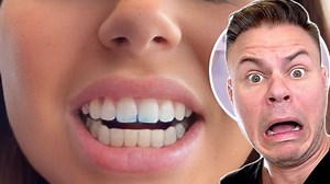 7.7K views · 109 reactions | Why Your Teeth Are MORE Important Than You Think! 醴 #dentures #teeth #dentist | TheBentistofficial | Facebook
