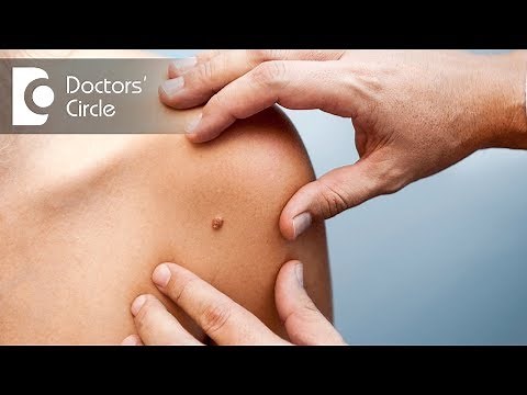 How to get rid of numerous brown birthmarks? - Dr. Aruna Prasad